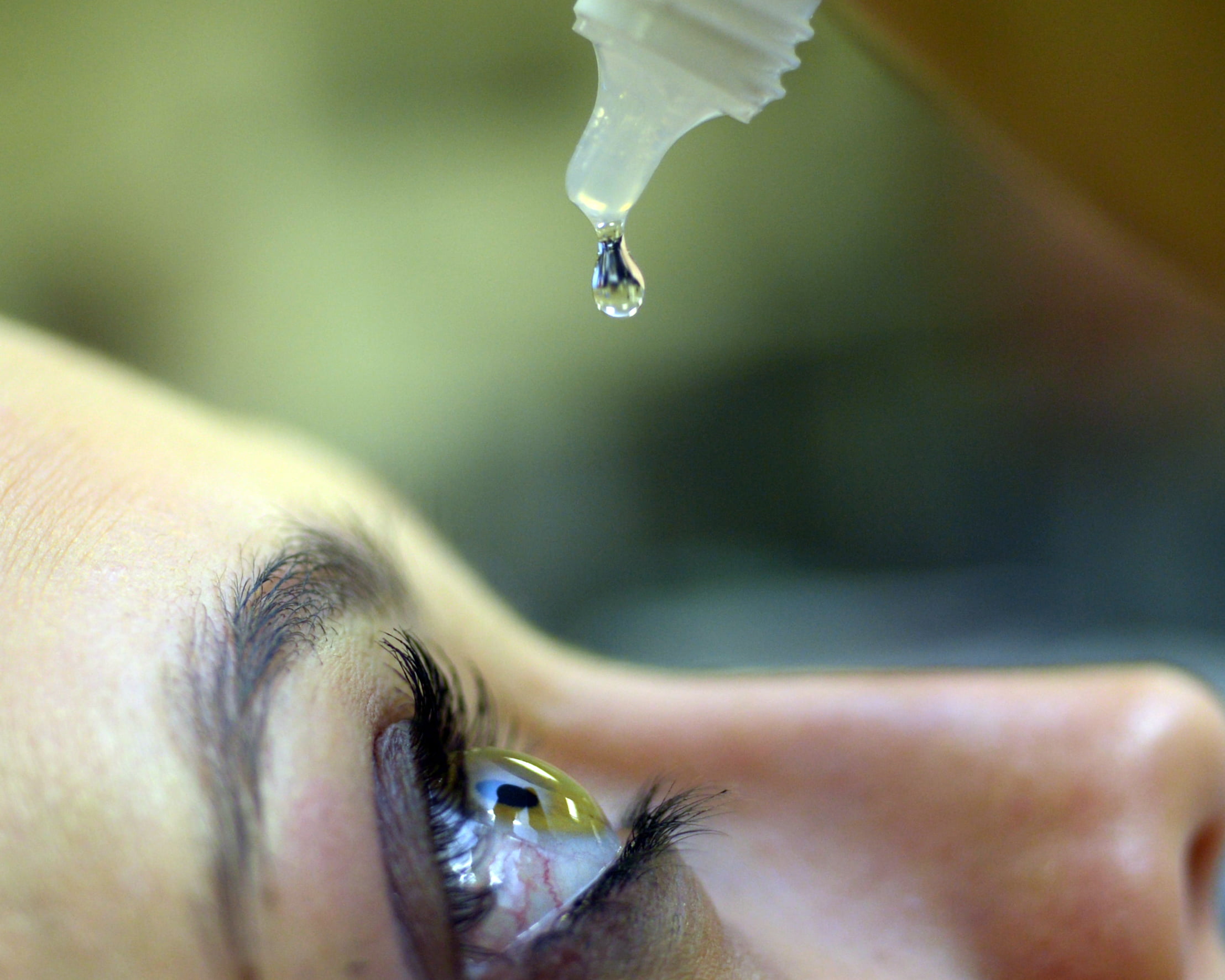 Colírio lente de contato | Dr. Marcelo Vilar