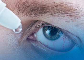 Olho seco - Cirurgias | Dr. Marcelo Vilar