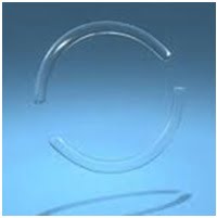 Ceratocone implante de anel | Dr. Marcelo Vilar
